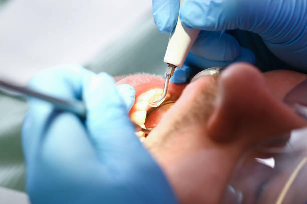 Best Broken or Cracked Tooth Emergency Dentist in Beacon Square, FL